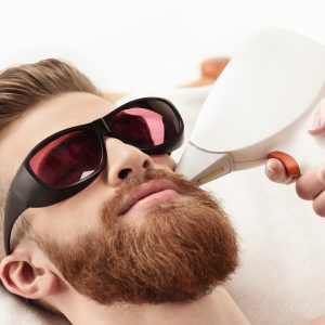 Depilación Láser Barba